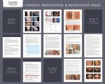 Laser Tattoo Removal Training Manual, Tattoo Removal Guide, Laser Tattoo Training Manual, Laser Clinic Tattoo Removal Course, Edit in Canva