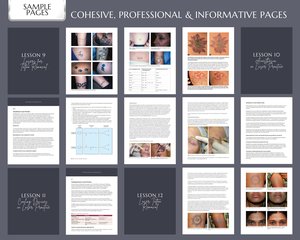 Laser Tattoo Removal Training Manual, Tattoo Removal Guide, Laser Tattoo Training Manual, Laser Clinic Tattoo Removal Course, Edit in Canva